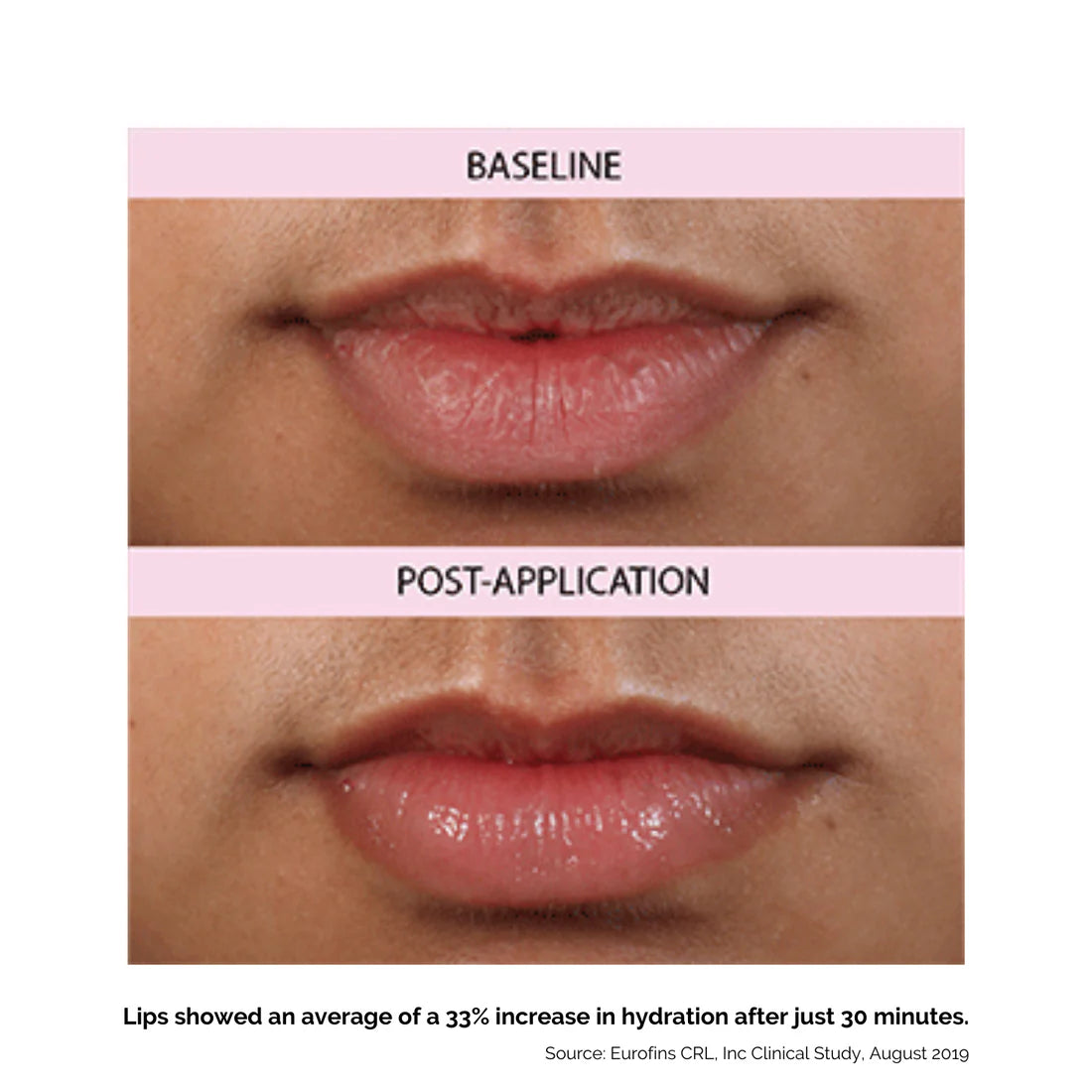 Lip Treatment for Soothing Dry Lips by Hanalei - Travel Pack (5g x 3)