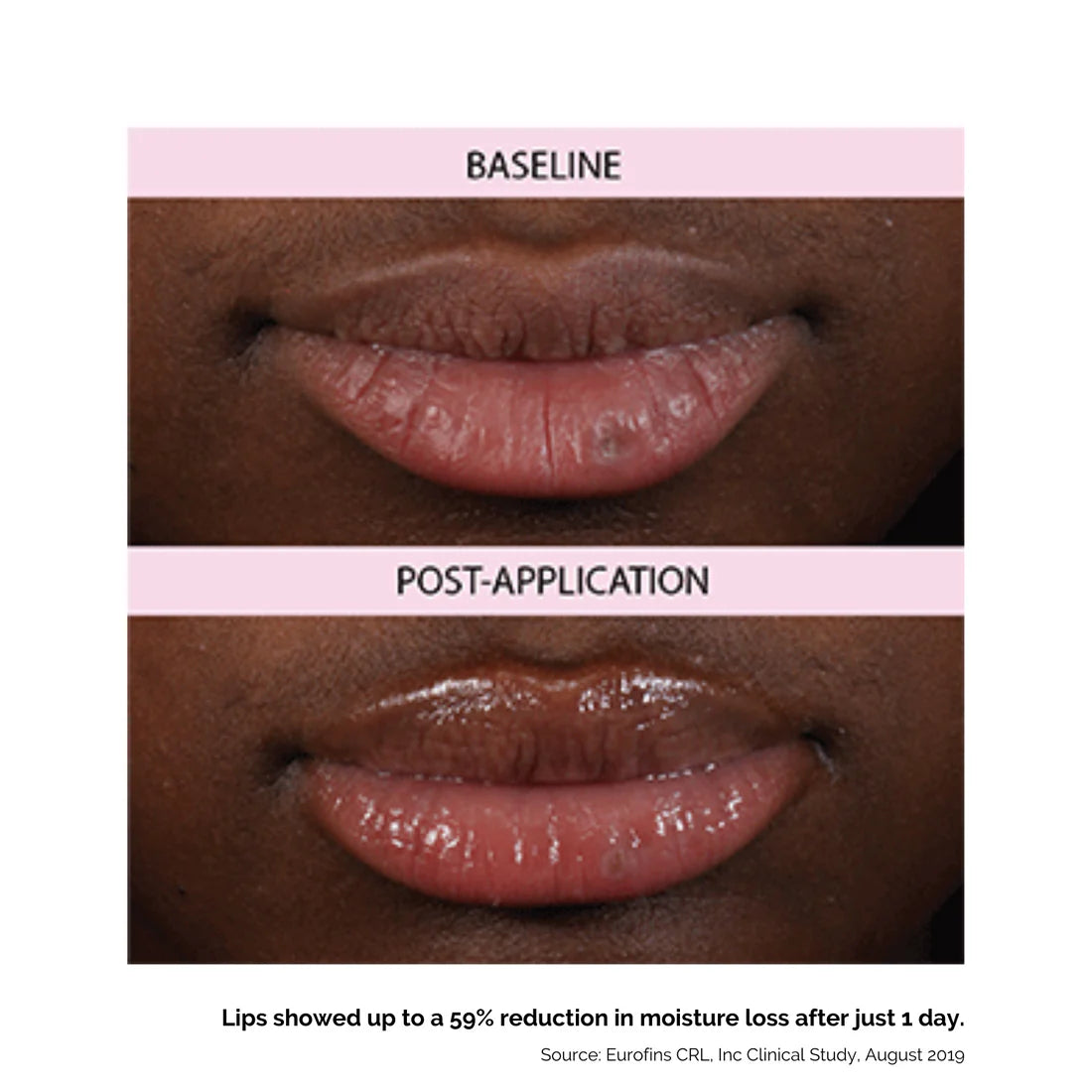 Lip Treatment for Soothing Dry Lips by Hanalei - Travel Pack (5g x 3)