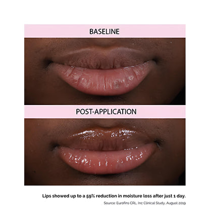Kukui Lip Oil Treatment Balm for Soothing Dry Lips by Hanalei - 15g