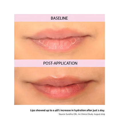 Kukui Lip Oil Treatment Balm for Soothing Dry Lips by Hanalei - 15g