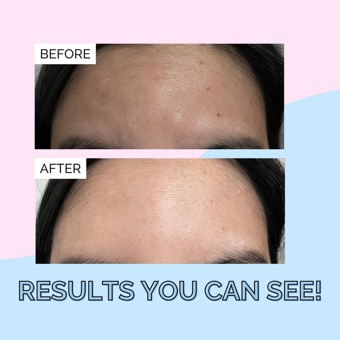 Korean Skincare Snail Mucin Serum by Elizabeth Mott - 100ml