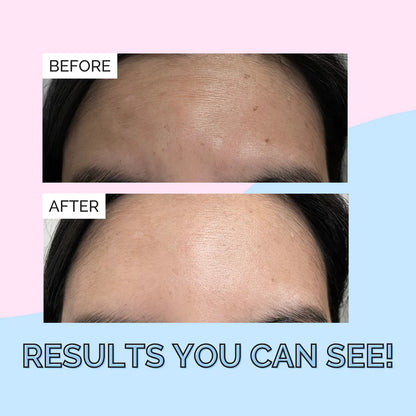 Korean Skincare Snail Mucin Serum by Elizabeth Mott - 100ml