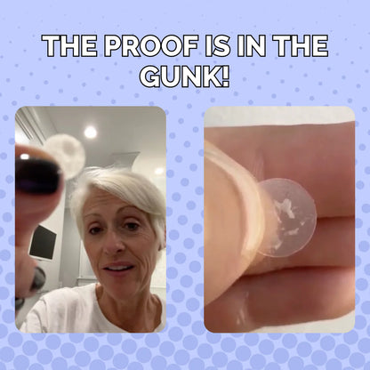 Spot Rescue Blemish Patches by Elizabeth Mott - 36 Patches